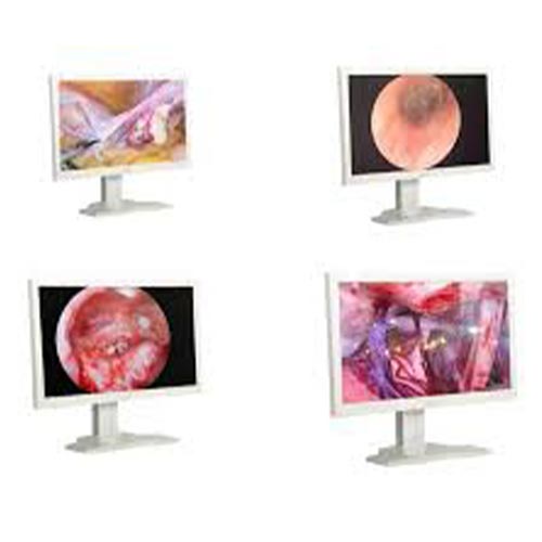 Medical Grade LG Monitor & Indian Medical Grade Monitor