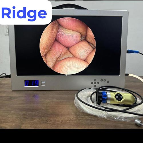 Handy ENT Neuro Full HD 1080p Endoscopy Camera