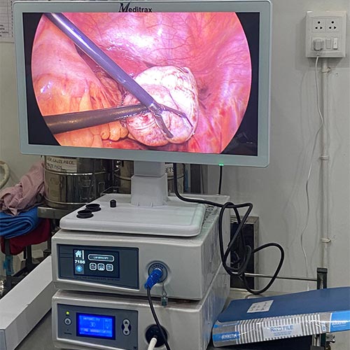 Laparoscopy & Hysteroscopy Full HD 1080p Endoscopy Camera