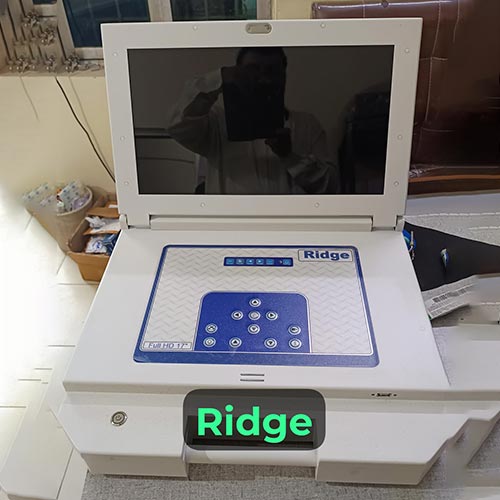 Portable Surgical Endoscopy Camera System - Laptop Type And Handy In Ghaziabad
