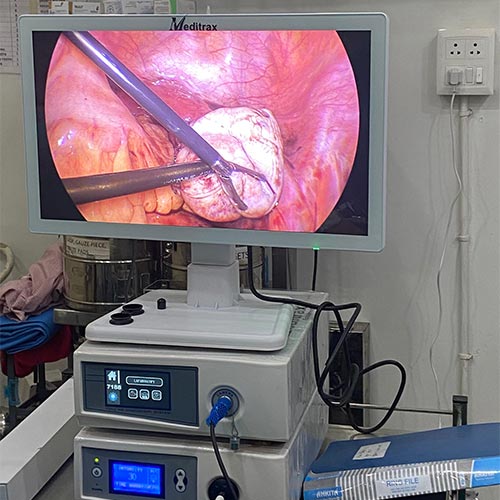 Urology Full HD 1080p Endoscopy Camera In Jodhpur